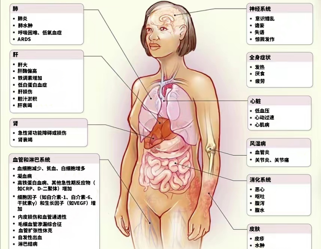 细胞因子风暴对器官影响