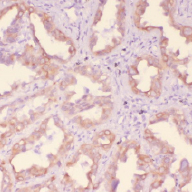 小鼠肺癌组化