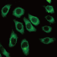 Hela细胞免疫荧光