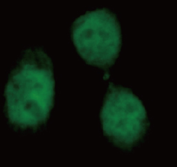 Hela细胞免疫荧光