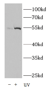FNab10910 Phospho-p53 (Ser15) antibody验证图片
