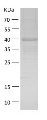 Recombinant Human RUNX1