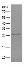 Recombinant Human GDF15